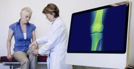 Associação Portuguesa de Osteoporose lança novo alerta para a saúde óssea da mulher