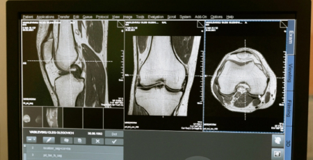 ULSCB adquire sistema moderno de densitometria