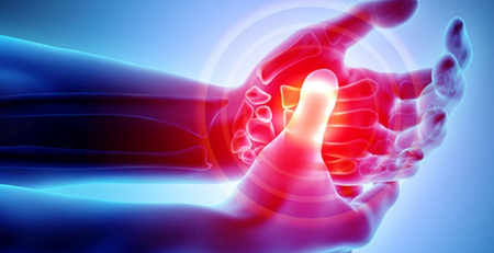 Mapa de iodo DECT deteta sítios anatómicos de lesões inflamatórias na artrite psoriática na mão