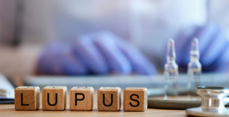 Lúpus regista atraso mediano de dois anos até ao diagnóstico
