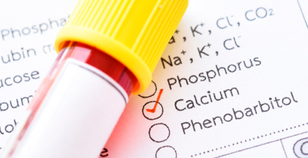 Cálcio: marcador laboratorial crucial na atividade de LES