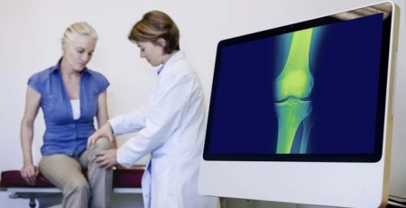 Kyowa Kirin recebe parecer positivo do CHMP para uso de burosumab para o tratamento de TIO